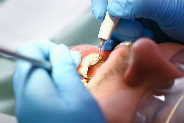 Best Weekend Emergency Dentist in Rock Creek, MN