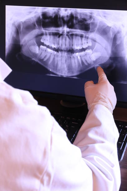 Best Emergency Tooth Extraction in Rock Creek, MN