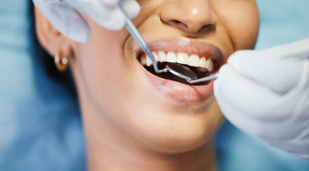 Best Emergency Wisdom Teeth Removal in Rock Creek, MN