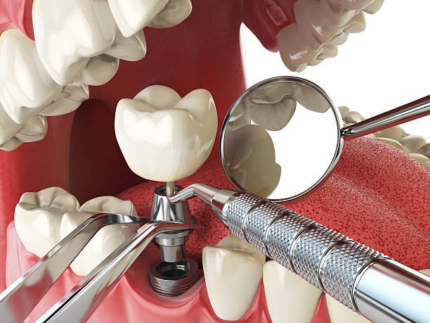 Best Emergency TMJ Treatment in Rock Creek, MN